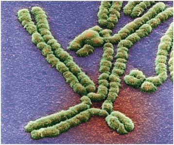 Colored electron micrograph of chromosomes