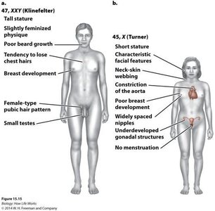 Diagram of Klinefelter and Turner syndrome phenotypes