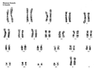 G-banded human female karyotype