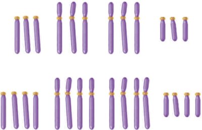 Diagram of aneuploid chromosome sets: trisomy and monosomy
