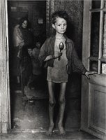 Dutch Hunger Winter and epigenetic effects