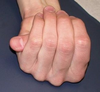 Graph showing distribution of dark-skin alleles in offspring