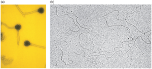 Electron micrograph of viral chromosomes