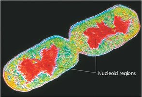 Image of nucleoid regions in a prokaryotic cell