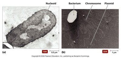Electron micrographs of prokaryotic nucleoid and chromosome