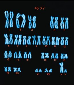 Human male karyotype