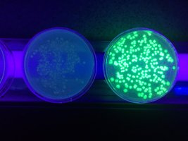 Microscopy image of C. elegans expressing GFP