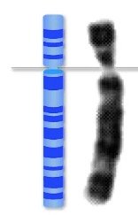 Pie chart of human genome composition, showing repetitive DNA