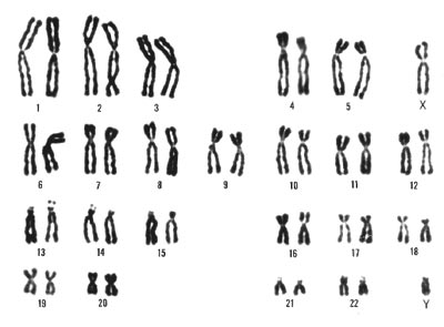 Human karyotype