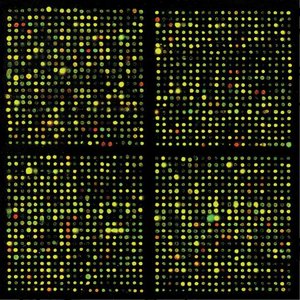 DNA microarray transcriptome comparison