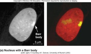 Nucleus with a Barr body