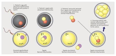 Pronuclear transfer technique for mitochondrial replacement