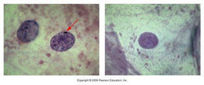 Barr body in female cell nucleus