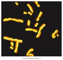 Sister chromatid exchanges (Harlequin chromosomes)