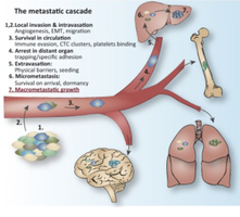 The metastatic cascade