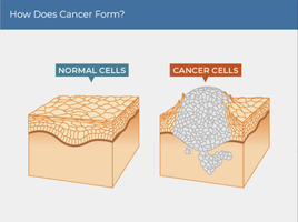 How does cancer form? Normal vs. cancer cells