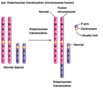 Robertsonian translocation