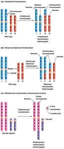 Types of translocations: unbalanced, reciprocal balanced, Robertsonian