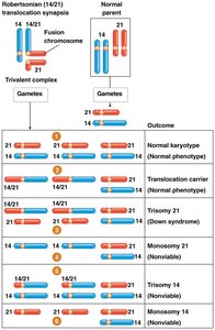 Robertsonian translocation and familial Down syndrome