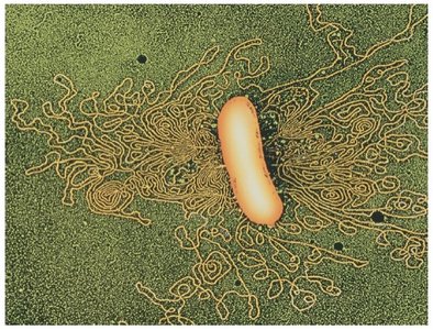 Colored electron micrograph of bacterial chromosome