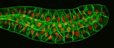 Polytene chromosomes in Drosophila