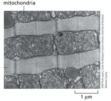 Electron micrograph of cardiac muscle mitochondria