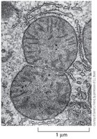 Electron micrograph of mitochondrial fission