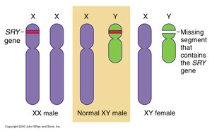SRY gene and its role in sex determination