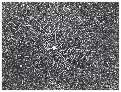 Electron micrograph of bacteriophage T2 DNA