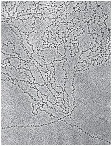 Electron micrograph of nucleosomes as beads on a string