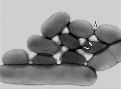 Mechanisms of horizontal gene transfer: transformation, transduction, conjugation