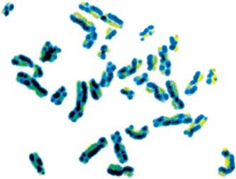 Harlequin chromosomes showing SCEs
