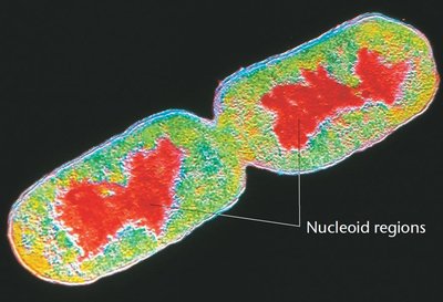 Color-enhanced electron micrograph of E. coli showing nucleoid regions