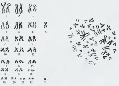 Human karyotype and metaphase chromosome preparation