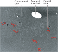 Electron micrograph of E. coli cell showing chromosomal and plasmid DNA