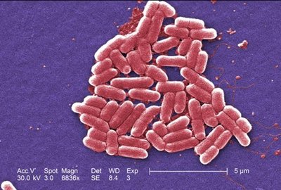 E. coli bacteria under electron microscope