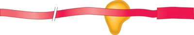 AU-rich elements and mRNA degradation
