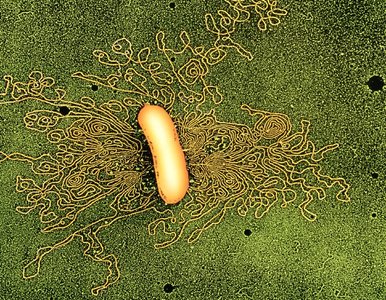 Electron micrograph of supercoiled bacterial DNA