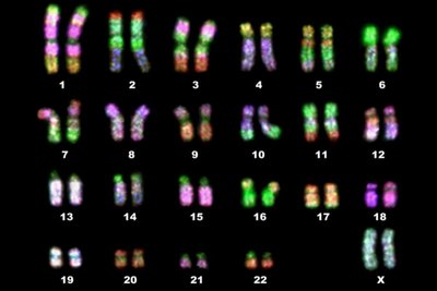 Human karyotype showing autosomes and sex chromosomes