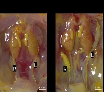 Left and right Müllerian ducts of E11.5 male embryos