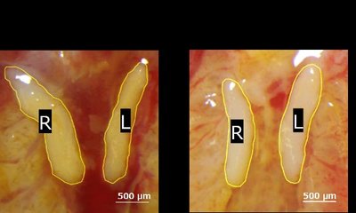 Left and right Müllerian ducts of E11.5 female embryos
