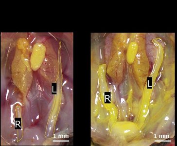 Left and right testes of E11.5 male embryos