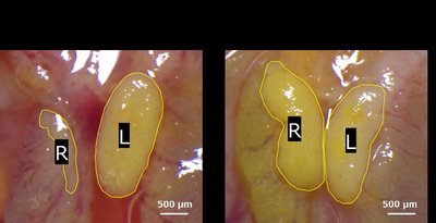 Left and right ovaries of E11.5 female embryos