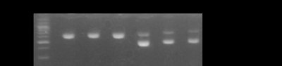 Agarose gel electrophoresis of PCR products for avian sex determination