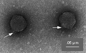 Electron micrograph of bacteriophages