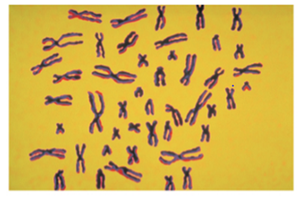 Micrograph of human metaphase chromosomes