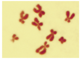 Micrograph of fruit fly metaphase chromosomes