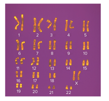 Karyotype with G-banding patterns