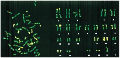 Karyotype image showing human chromosomes