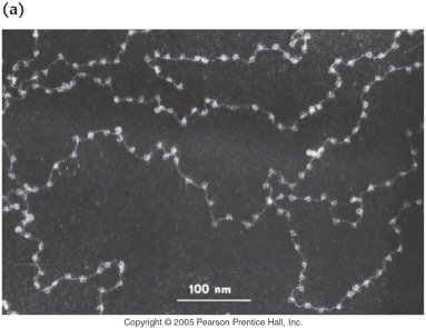 Electron micrograph of chromatin structure